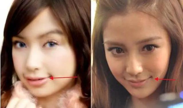 长得“歪瓜裂枣”，整得“美若天仙”，这6位都靠脸逆天改命