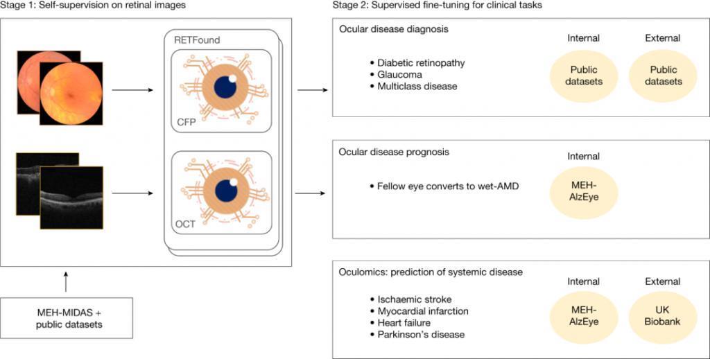 只看了你一“眼”，AI 就能预测帕金森？