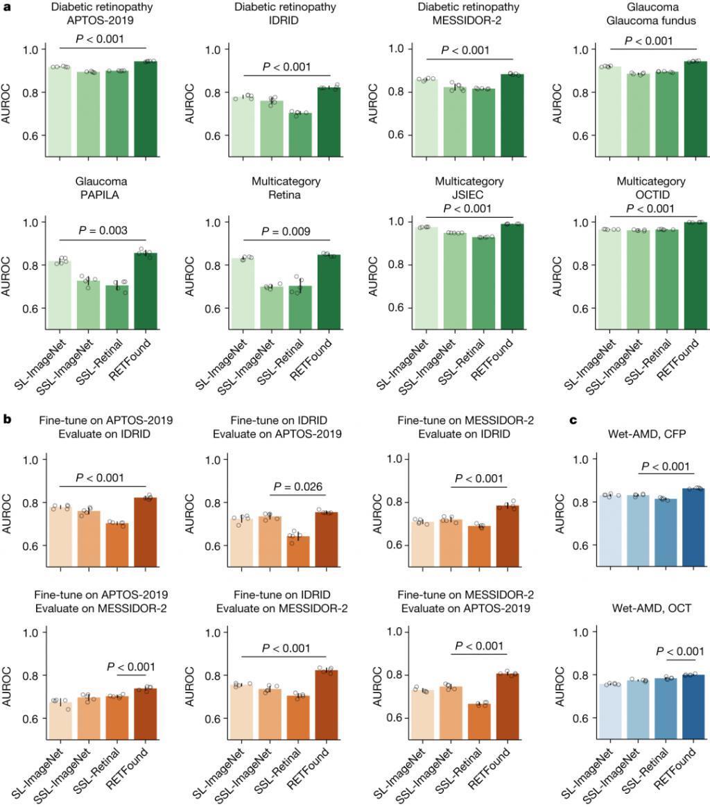 只看了你一“眼”，AI 就能预测帕金森？