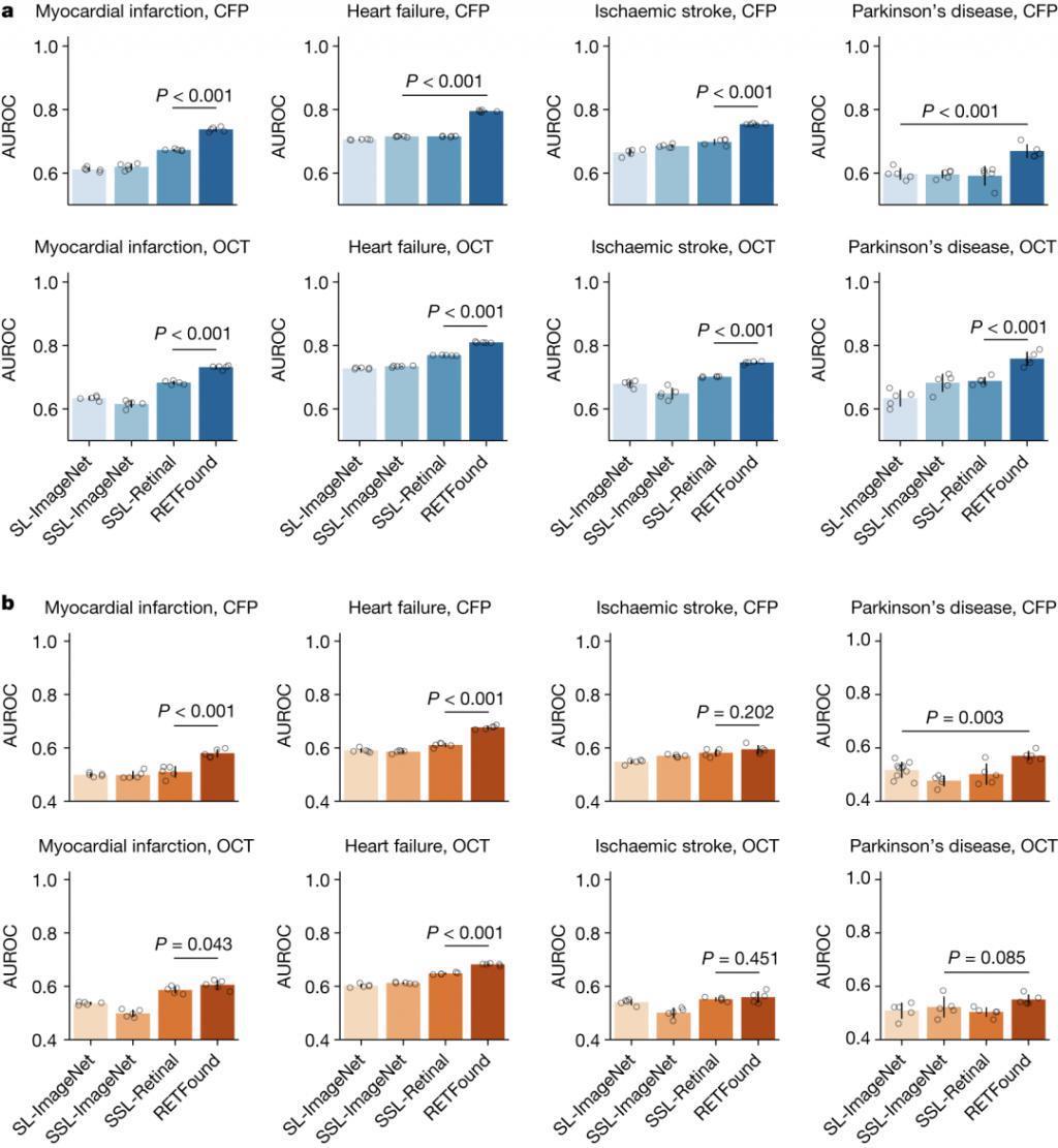 只看了你一“眼”，AI 就能预测帕金森？