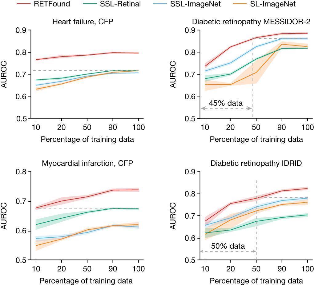 只看了你一“眼”，AI 就能预测帕金森？