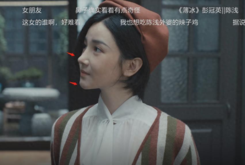 “硅胶脸”混入谍战剧，求求这5位女演员，别再辣观众眼睛了