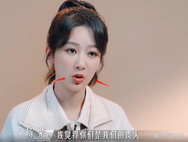 杨紫综艺上线暴露状态，下巴变尖，网友吐槽医美后遗症
