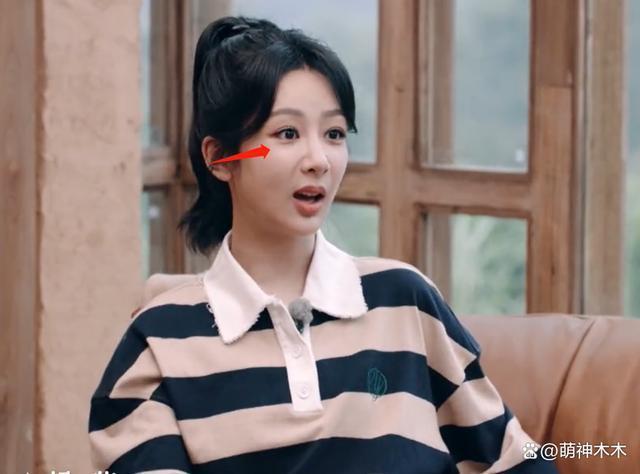 杨紫综艺上线暴露状态，下巴变尖，网友吐槽医美后遗症