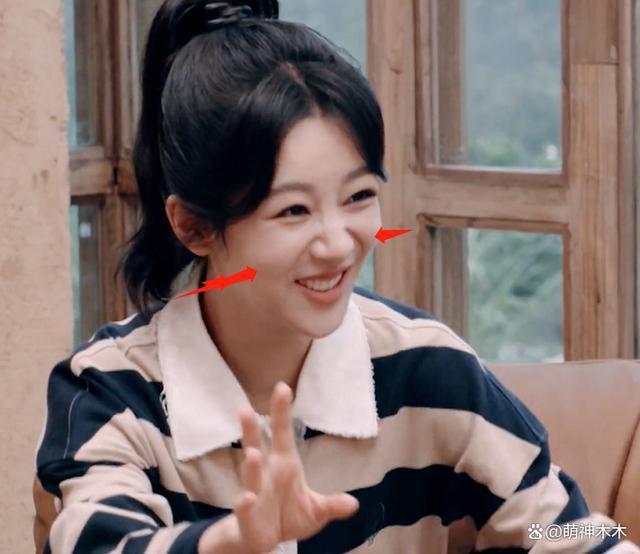 杨紫综艺上线暴露状态，下巴变尖，网友吐槽医美后遗症