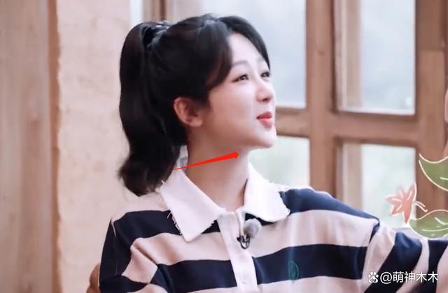 杨紫综艺上线暴露状态，下巴变尖，网友吐槽医美后遗症