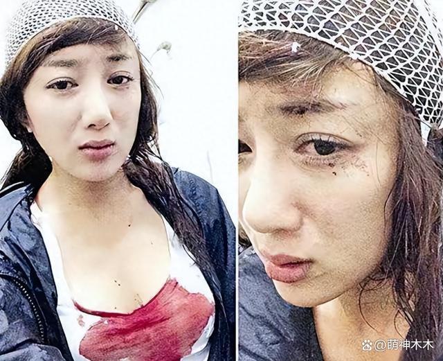 娱乐圈纵狗伤人的明星，致人毁容、害死老人，一个比一个过分