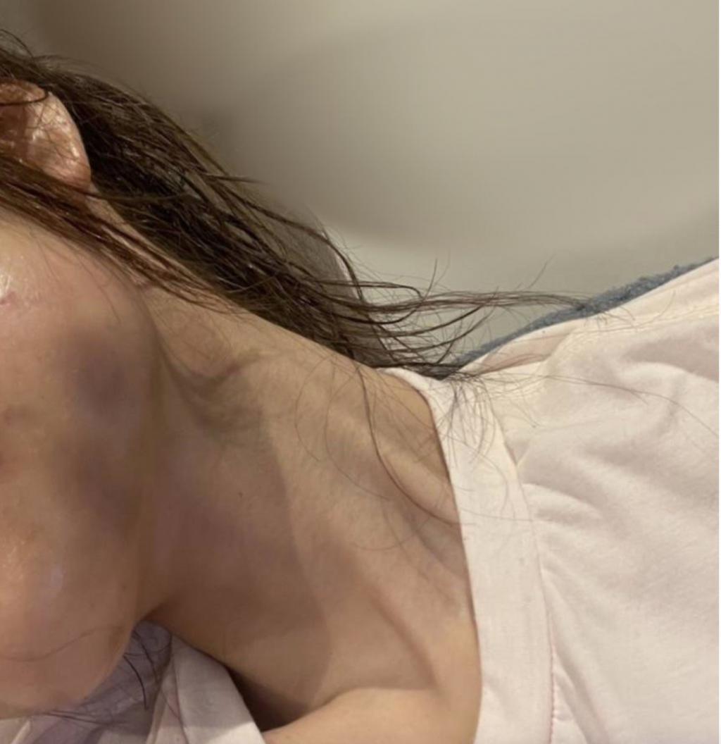 日本牛郎主播被当街砍杀,吃女粉丝软饭,还将其打到毁容住院半年