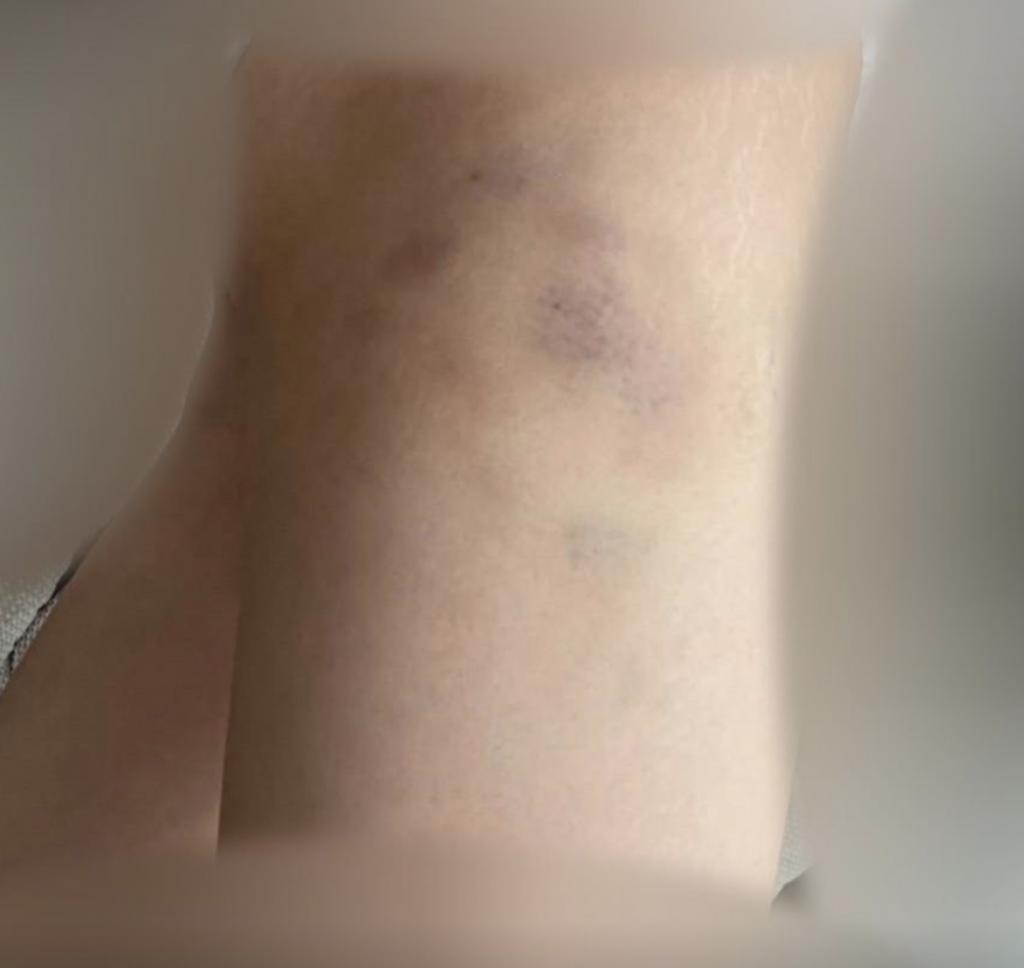 日本牛郎主播被当街砍杀,吃女粉丝软饭,还将其打到毁容住院半年