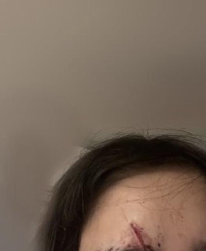 日本牛郎主播被当街砍杀,吃女粉丝软饭,还将其打到毁容住院半年