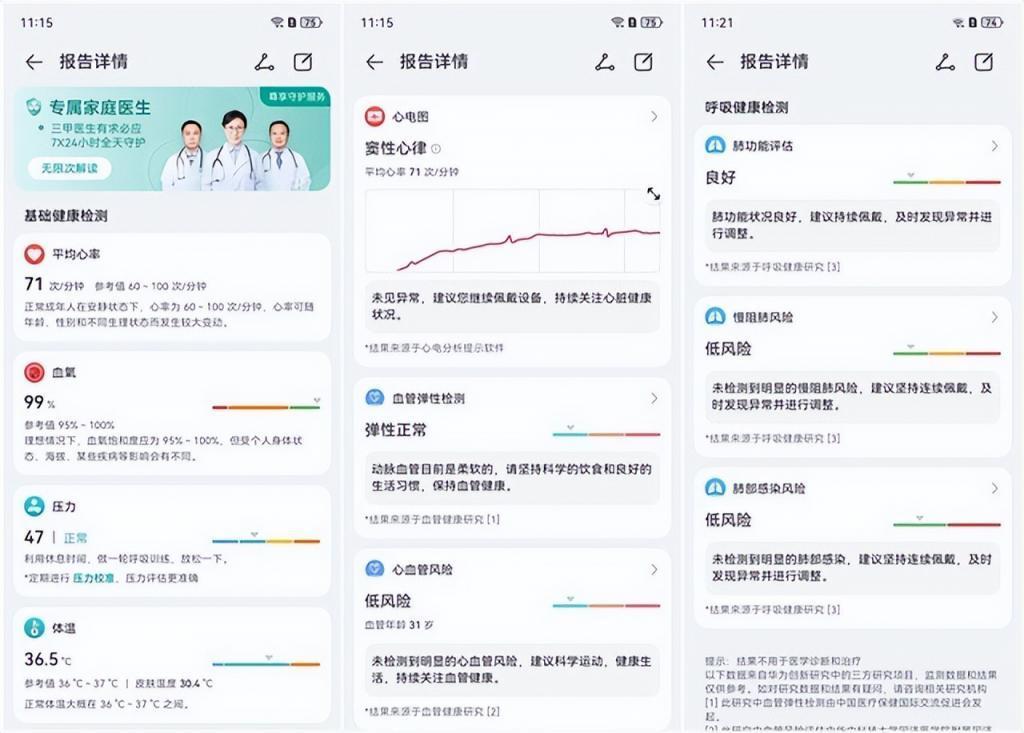 HUAWEI WATCH 4 系列＆WATCH GT 4体验：双十一运动健康好物不二之选