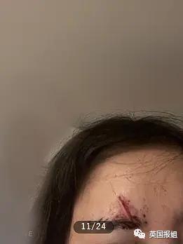 25岁日本女街头割喉牛郎，被骗1800万还被家暴揍断肋骨？