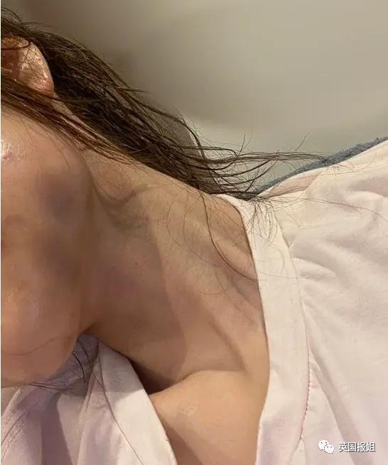 25岁日本女街头割喉牛郎，被骗1800万还被家暴揍断肋骨？