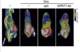 中山二院学生患癌疑云，与实验室环境、试剂有关吗？