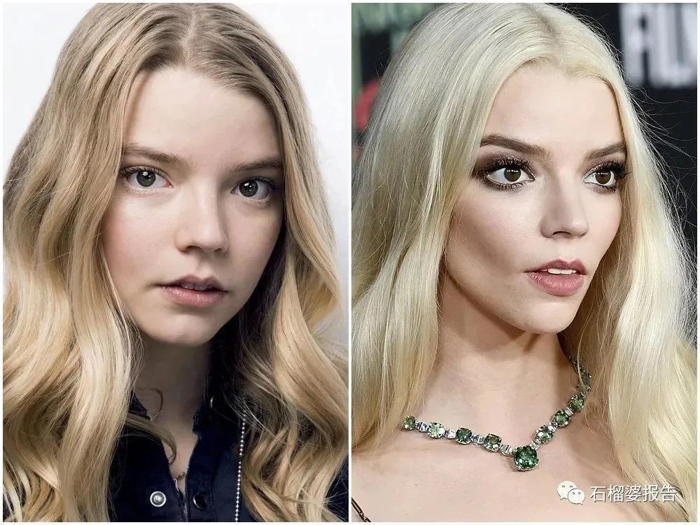 好莱坞集体瘦脸，又有了新的整形重点？