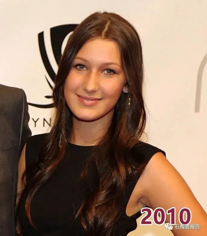 好莱坞集体瘦脸，又有了新的整形重点？