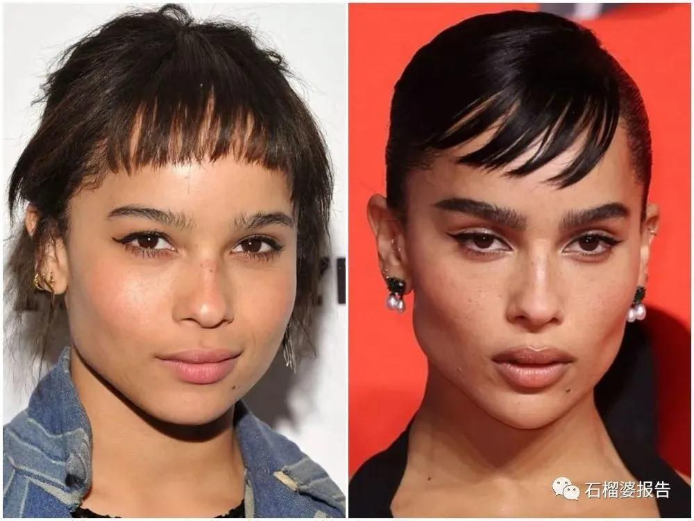 好莱坞集体瘦脸，又有了新的整形重点？