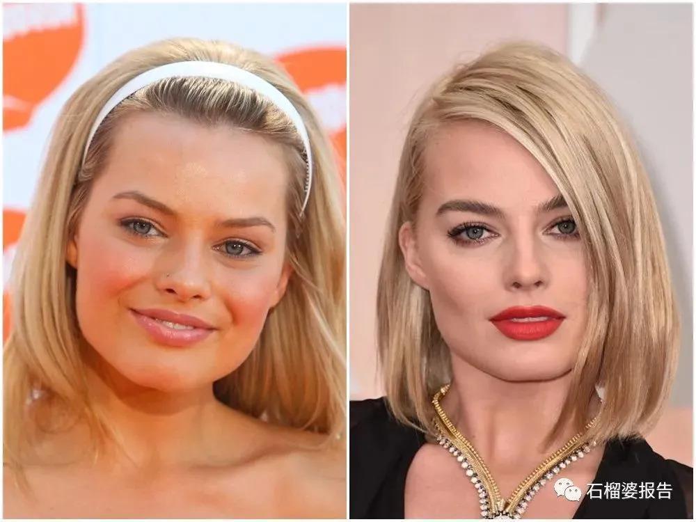 好莱坞集体瘦脸，又有了新的整形重点？