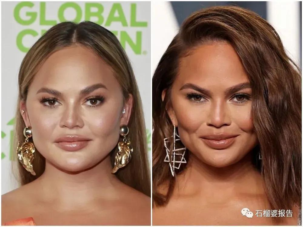 好莱坞集体瘦脸，又有了新的整形重点？