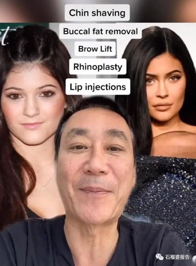 好莱坞集体瘦脸，又有了新的整形重点？