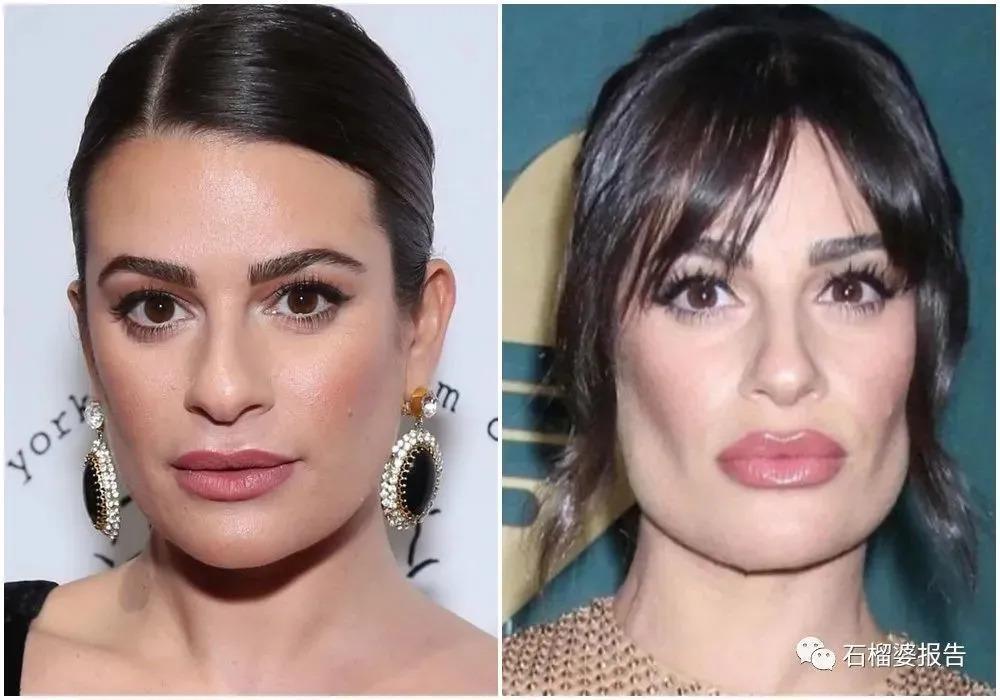 好莱坞集体瘦脸，又有了新的整形重点？