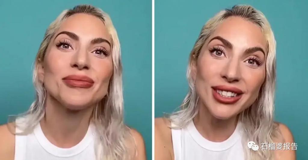 好莱坞集体瘦脸，又有了新的整形重点？