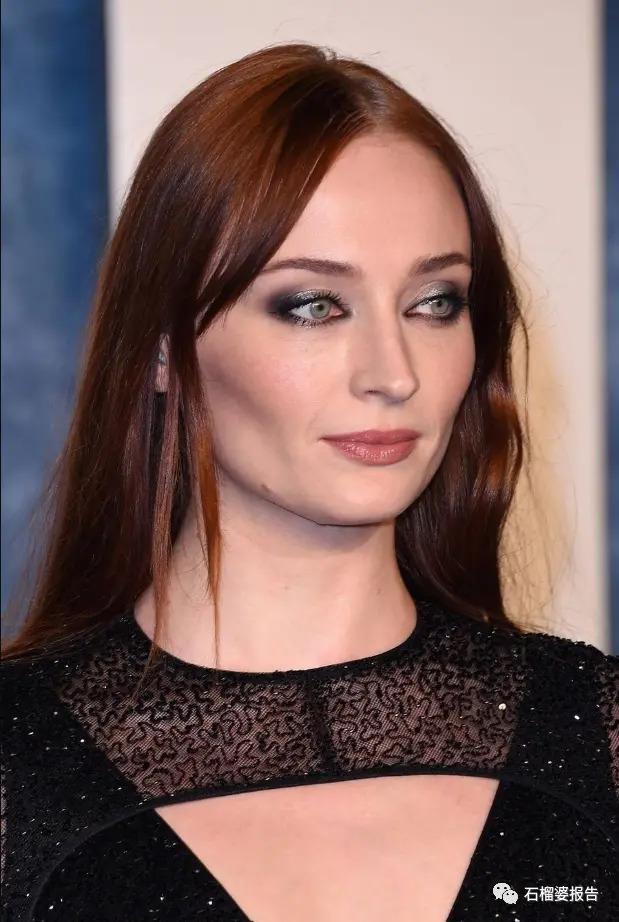 好莱坞集体瘦脸，又有了新的整形重点？