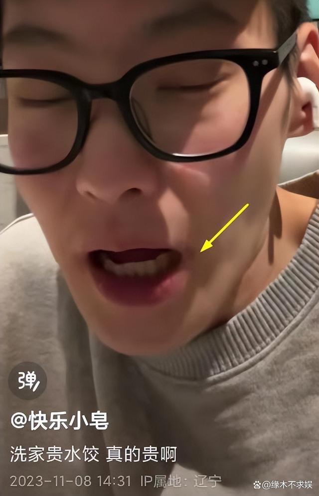 29岁快乐小赵因遗传病去世！原生家庭太窒息，最后露面暴瘦烂嘴！