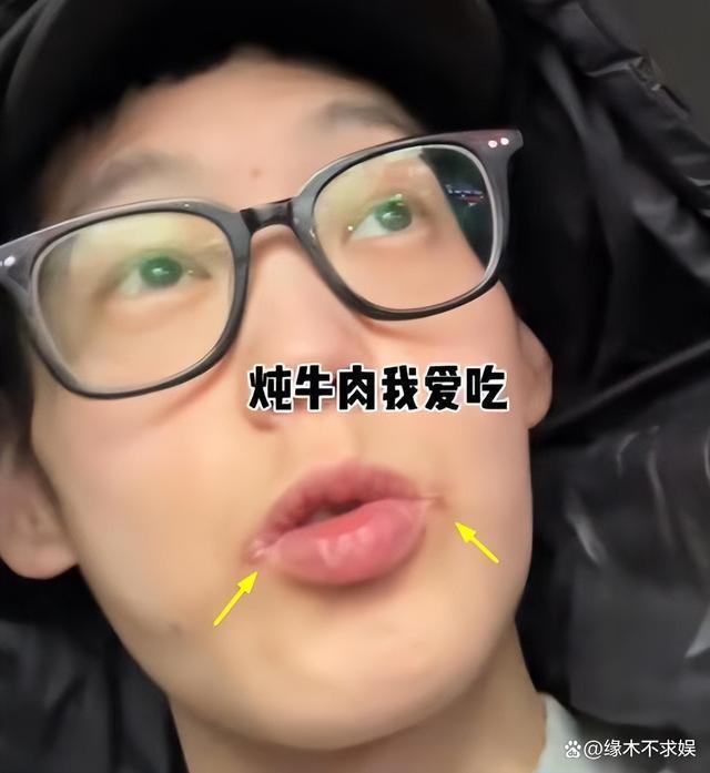 29岁快乐小赵因遗传病去世！原生家庭太窒息，最后露面暴瘦烂嘴！