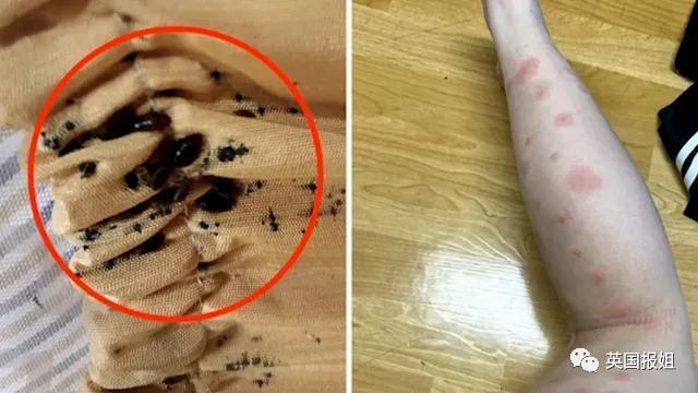 巴黎嗜血臭虫已到亚洲！韩国大学寝室商店健身房现大面积虫卵，香港地铁也遭侵袭？！