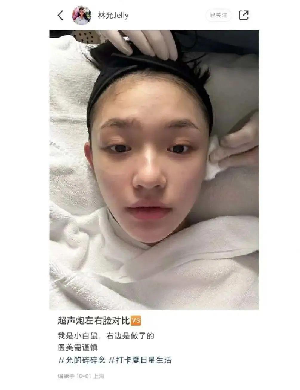 动个脸被百万网友围观，这女明星太会炒作了