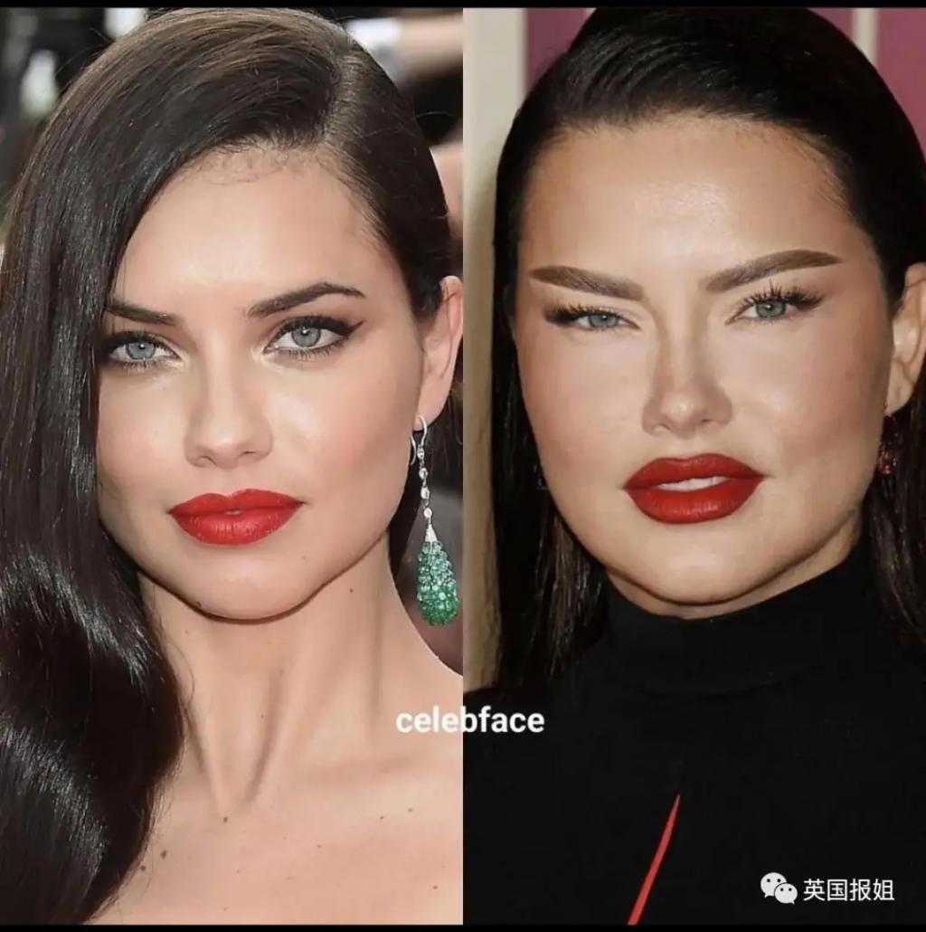 外网热议！维密最狂野性感超模“毁容”？最新照片面部爆肿大变样