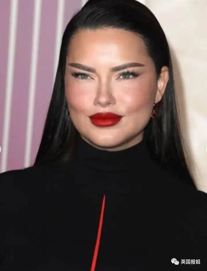 外网热议！维密最狂野性感超模“毁容”？最新照片面部爆肿大变样