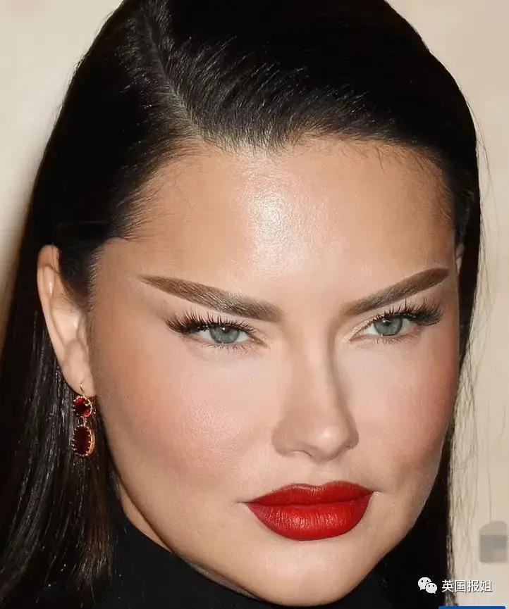 外网热议！维密最狂野性感超模“毁容”？最新照片面部爆肿大变样