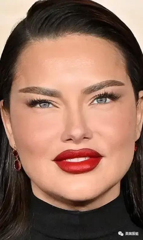 外网热议！维密最狂野性感超模“毁容”？最新照片面部爆肿大变样