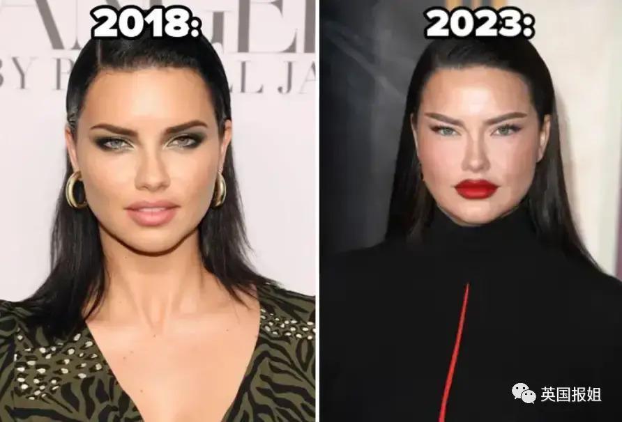 外网热议！维密最狂野性感超模“毁容”？最新照片面部爆肿大变样