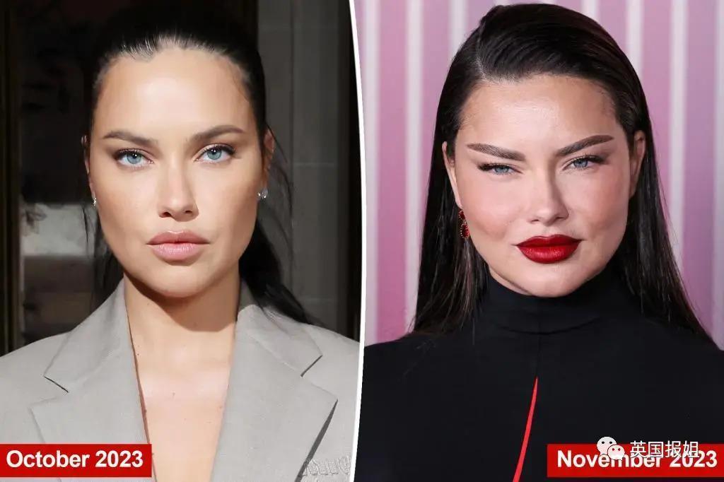 外网热议！维密最狂野性感超模“毁容”？最新照片面部爆肿大变样