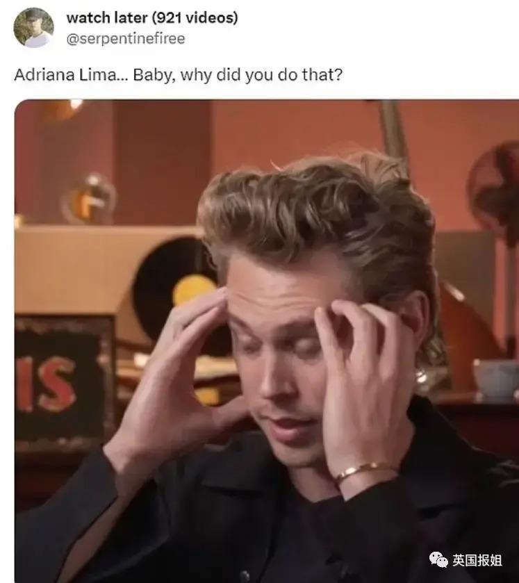 外网热议！维密最狂野性感超模“毁容”？最新照片面部爆肿大变样