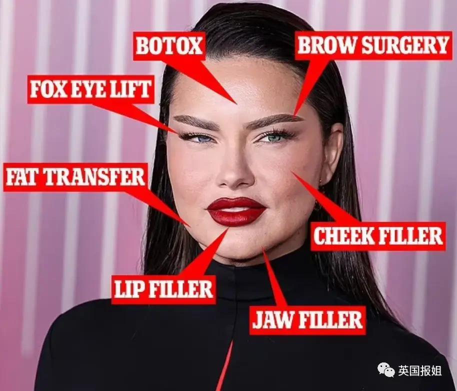 外网热议！维密最狂野性感超模“毁容”？最新照片面部爆肿大变样