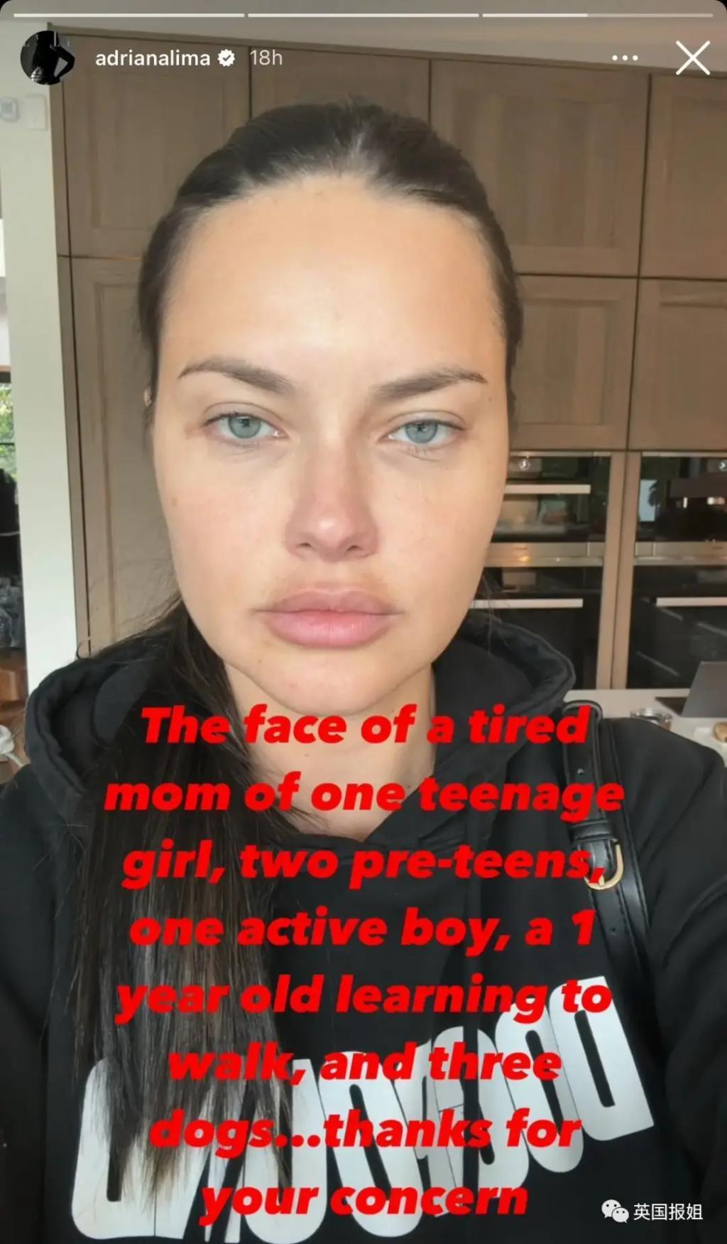 外网热议！维密最狂野性感超模“毁容”？最新照片面部爆肿大变样