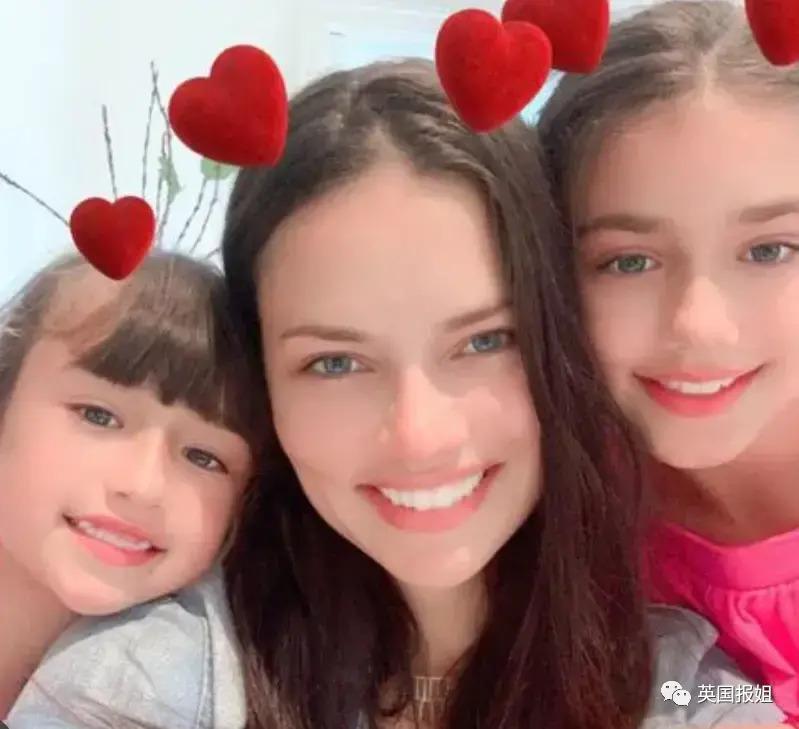 外网热议！维密最狂野性感超模“毁容”？最新照片面部爆肿大变样