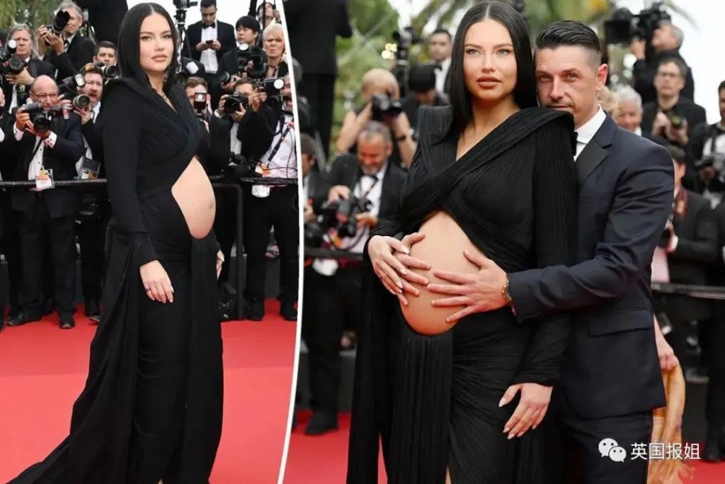 外网热议！维密最狂野性感超模“毁容”？最新照片面部爆肿大变样