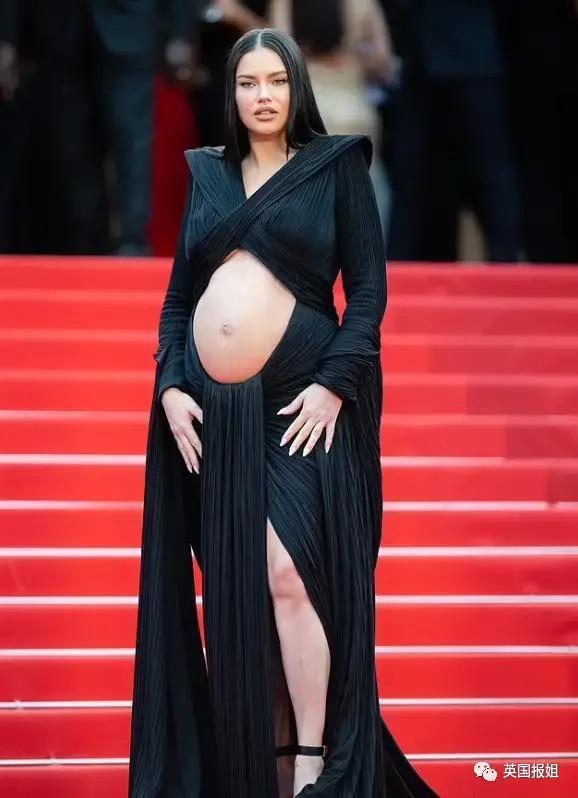 外网热议！维密最狂野性感超模“毁容”？最新照片面部爆肿大变样