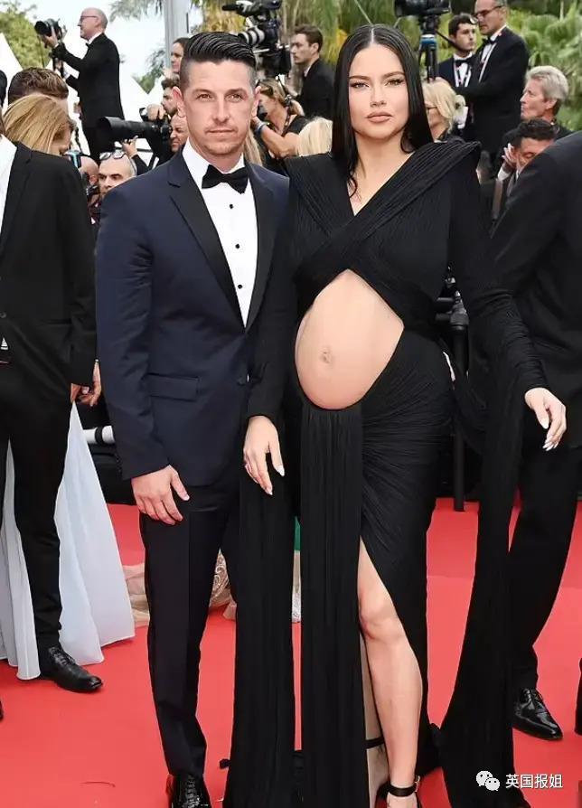 外网热议！维密最狂野性感超模“毁容”？最新照片面部爆肿大变样