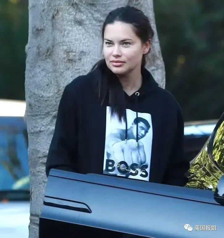 外网热议！维密最狂野性感超模“毁容”？最新照片面部爆肿大变样