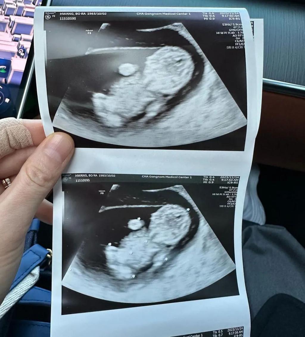 群星感动祝福！四次试管历经痛苦的她终于要当妈妈了！