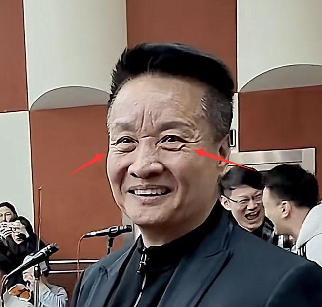 66岁阎维文近照曝光变化巨大，为照顾患癌妻子苍老太多