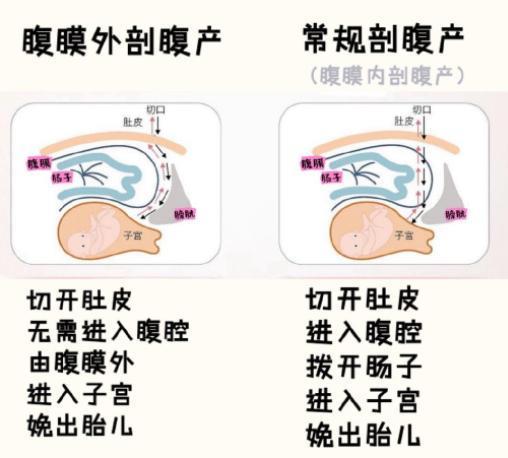 他俩是怎么做到风评在忽好忽坏之间反复跳横的？