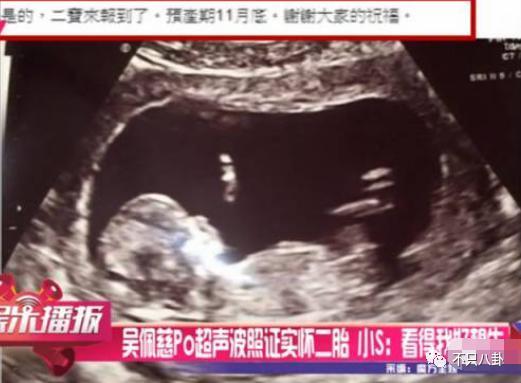 豪门梦碎，她反而成了最精明的女明星？