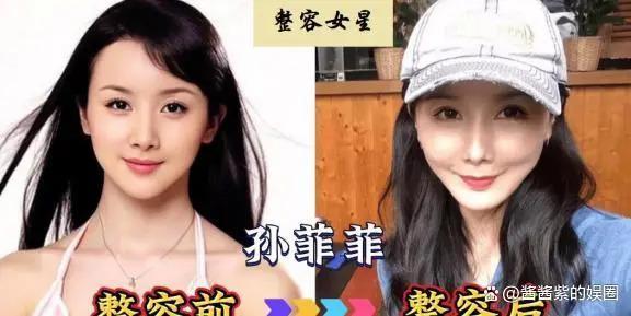 被整容毁了的14位女星，出道时貌美如花，如今灵气全无